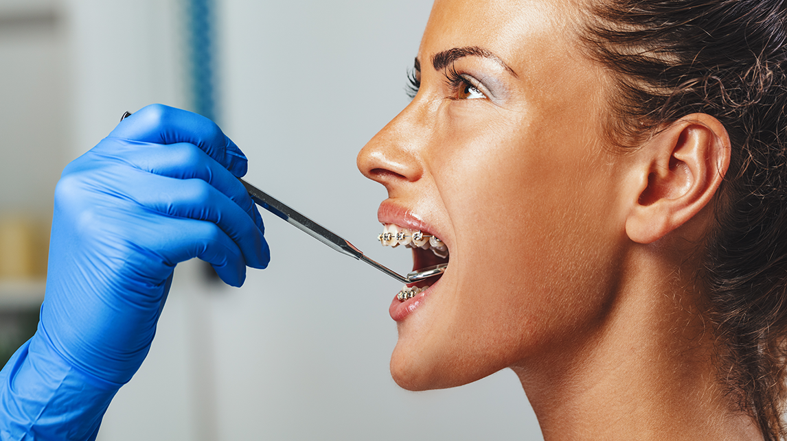 dentistas illescas opiniones