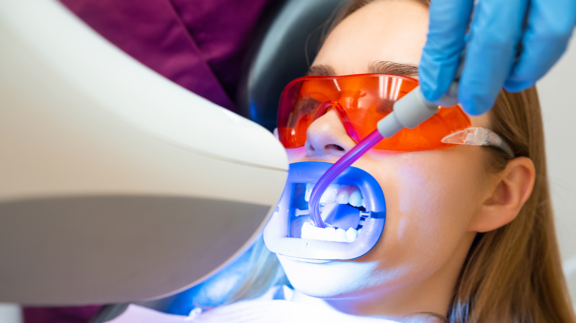 blanqueamiento dental illescas