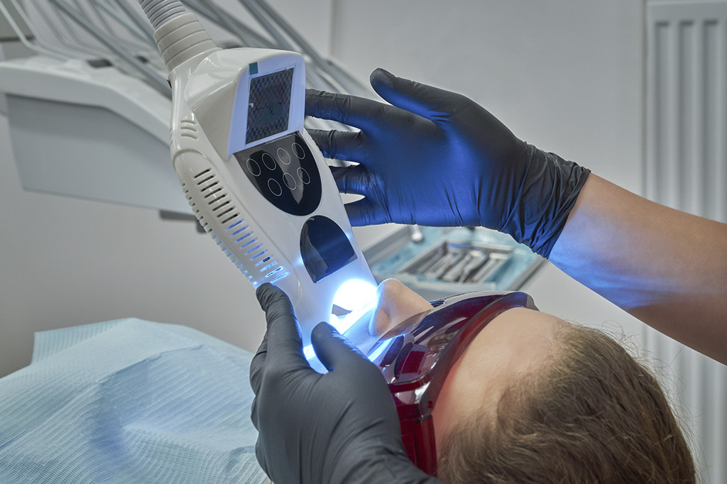 blanqueamiento dental illescas