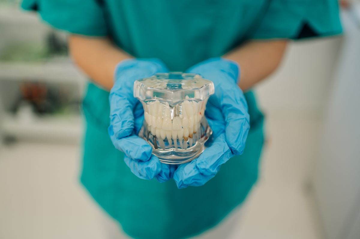 cuidados tras implantes dentales