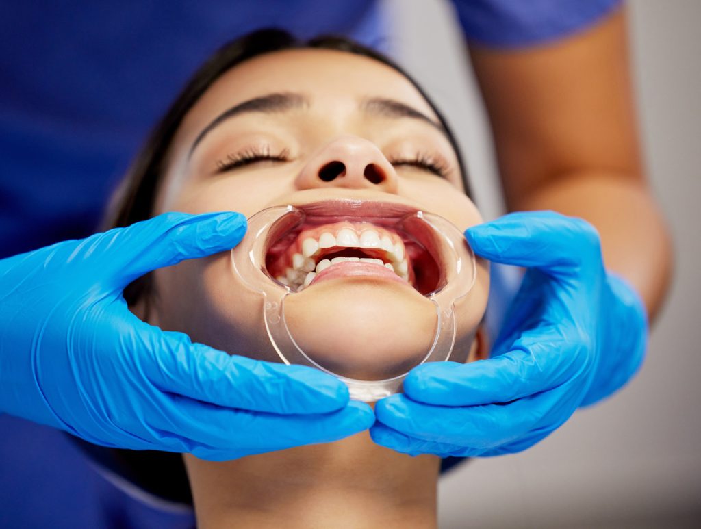 estética dental illescas