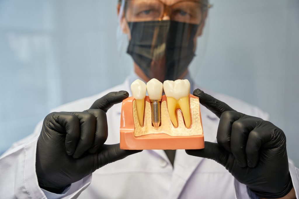 Implantes dentales para mayores en Illescas