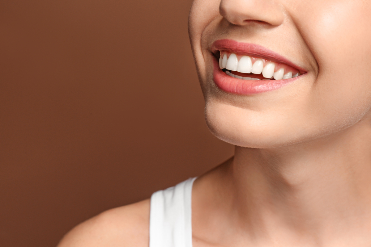 carillas dentales Illescas